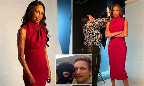Inspirational Burns Survivor Turia Pitt Reveals How She Learned To Feel Attractive Again Daily