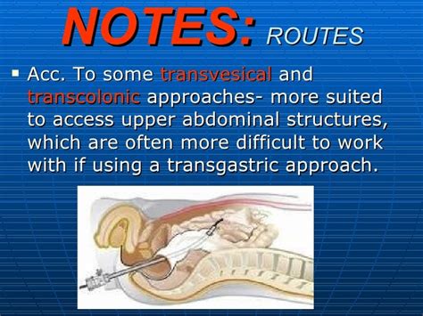 Notes Natural Orifice Transluminal Endoscopic Surgery By Dr Onkar