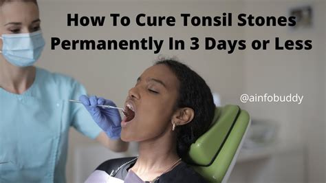 How To Cure Tonsil Stones Permanently In 3 Days Or Less Youtube