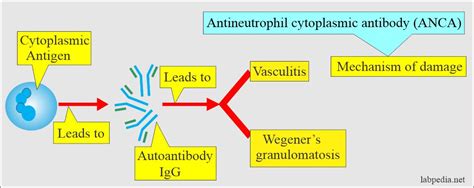 Antineutrophil Cytoplasmic Antibody Anca Wegeners Granulomatosis