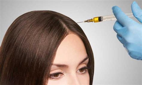 A person can shed 50 to 100 strands of hair a day and platelet rich plasma (prp) therapy is an innovative new treatment that can be used to treat many kinds of health issues. Global Alopecia Treatment (Hair Loss) Market 2020:Analysis,
