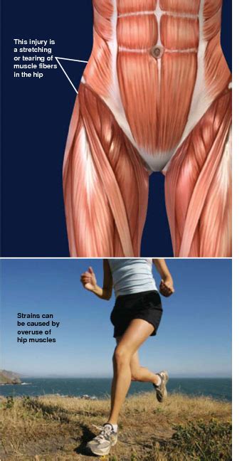 The hip flexors connect your hip bones to your leg bones. Muscle Strain Injuries of the Hip - Orthopaedic Associates of Riverside