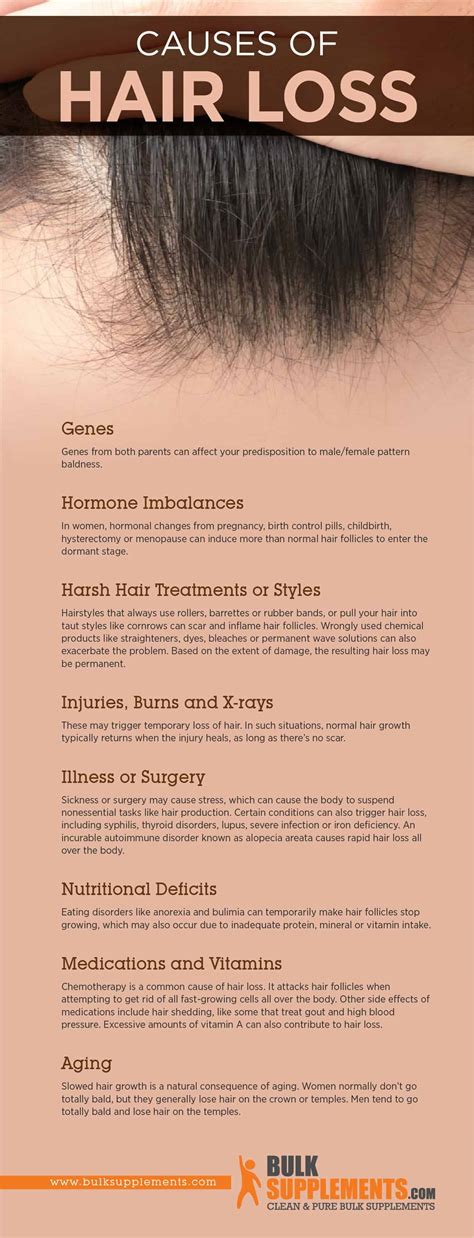 Hair Loss Characteristics Causes And Treatment By James Denlinger