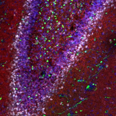 Confocal Images Of Dentate Gyrus Development