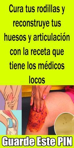 Ideas De Dolor En La Rodilla Dolor En La Rodilla Recetas Para La