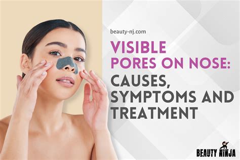 Visible Pores On Nose Causes Symptoms And Treatment Beauty Ninja