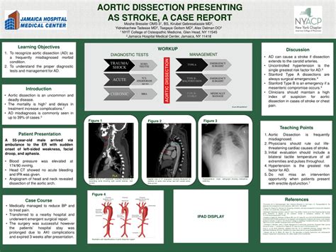 Pdf Aortic Dissection Presenting As Stroke A Case Report