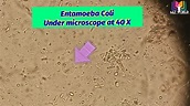 E.Coli under microscope. Entamoeba Coli Parasite in stool microscopy.E ...