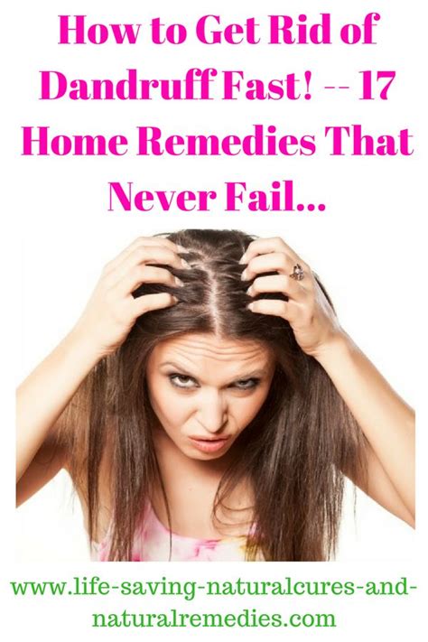 Best Natural Remedies And Home Treatments For Dandruff Home Remedies