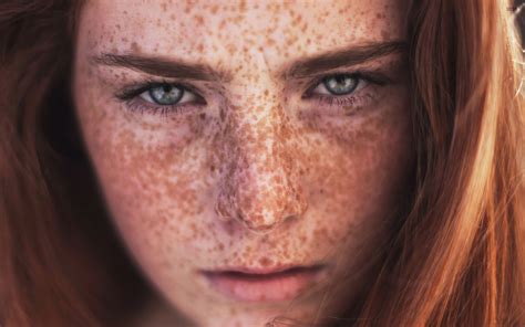 Freckled Girls High Definition