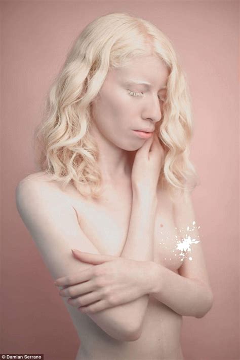 pictures of albino nude girls