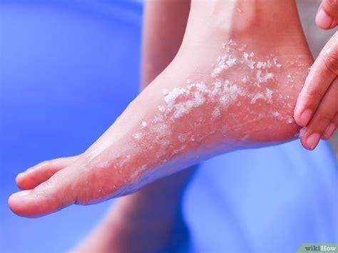 How To Remove Dry Skin From Your Feet Using Epsom Salt Dry Flaky Skin
