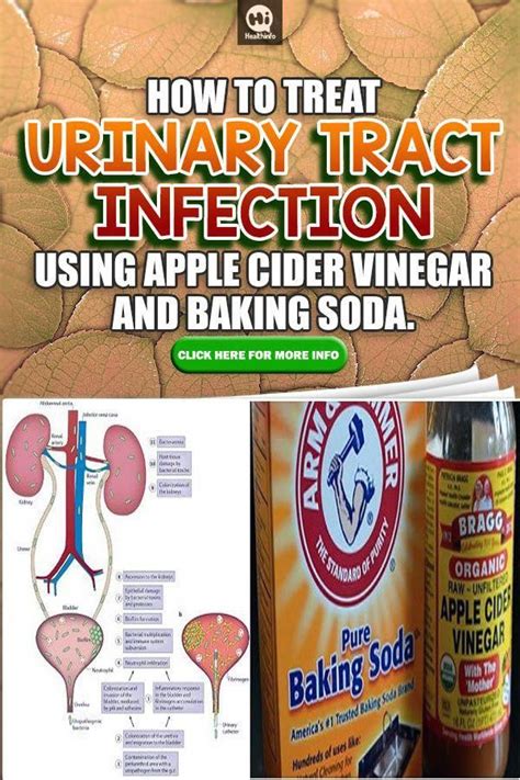 Urinary System Tract Infection Treatment Quick Signs And Symptoms With Ideal C Apple Cider