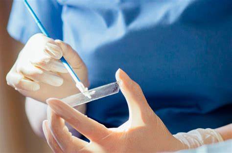 Диета рак шейки матки Мазок на цитологию шейки матки: виды исследования, как правильно сдать Мазок на цитологию шейки матки: виды исследования, как правильно сдать Диета рак шейки матки