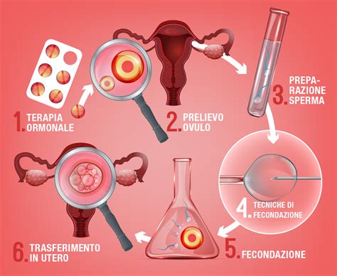 Procreazione Medicalmente Assistita Pma Centro Palmer