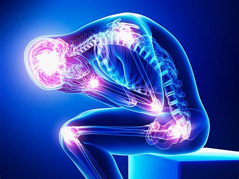 Convert jpg to ico format using this free online tool. Chronic Pain | Perth, WA | Image Dental