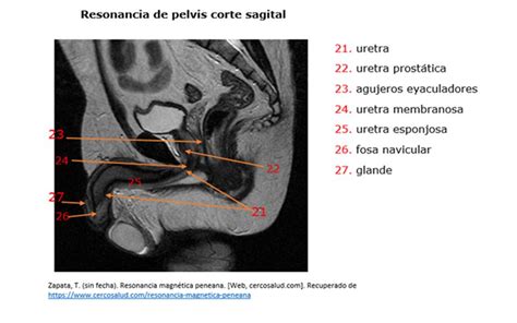Blog De Anatomía Radiológica Humana Unad Grupo 15400340 2018