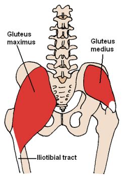 C'est un département spécial principalement pour le. Gluteus medius myalgie / triggerpoint.