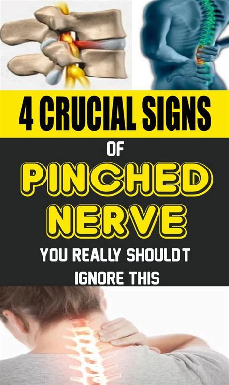Health Medicine 4 Crucial Signs Of A Pinched Nerve You Really Shouldt