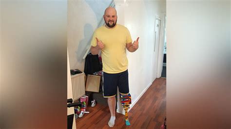 Amputee Builds Himself Lego Leg While Waiting For Prosthetic Limb — Rt