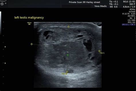 Well Man Diamond Full Body Scan Package Private Ultrasound Scans London