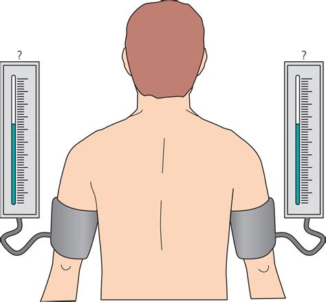 Blood Pressure Measurement Thoracic Key