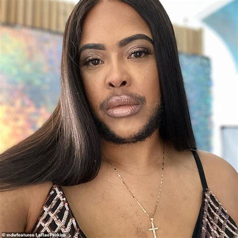 Woman Who Suffers From Hormonal Disorder Which Makes Facial Hair Grow Decides To Embrace Her