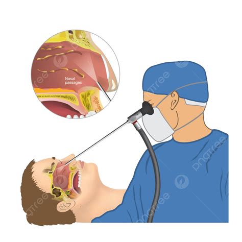 内視鏡下副鼻腔手術アリ鼻の解剖学 ベクターイラスト画像とpngフリー素材透過の無料ダウンロード Pngtree