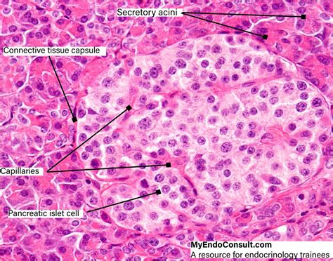 Islet Cells Of The Pancreas Myendoconsult