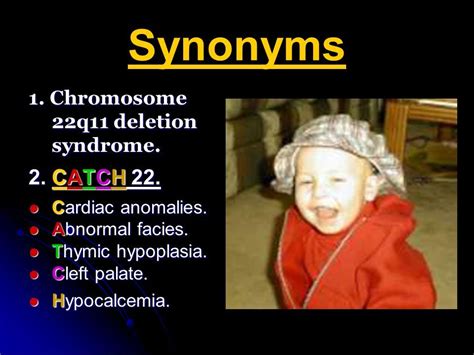Signs and symptoms may include: Pin by nonas arc on DiGeorge Syndrome | Pinterest ...