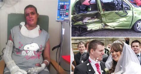 Woman Who Nearly Died In A Fireball During A Driving Lesson Learns To