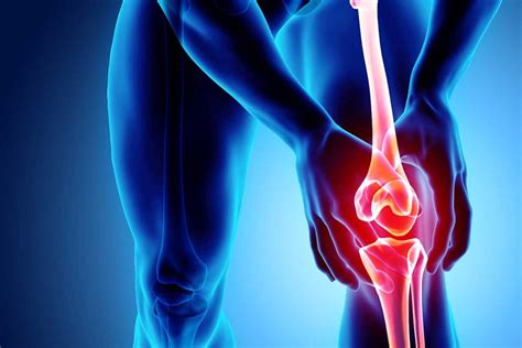 What Can I Do For Chronic Knee Pain San Diego Ca