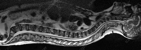 Bone Marrow Cancer Mri Scan Stock Image C0037303 Science Photo