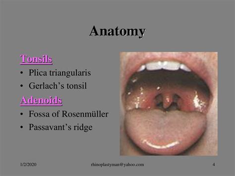 Ppt Tonsillectomy And Adenoidectomy Powerpoint Presentation Free