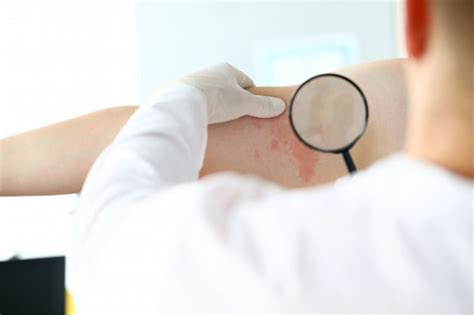 5 Skin Cancer Treatment Options In The Philippines