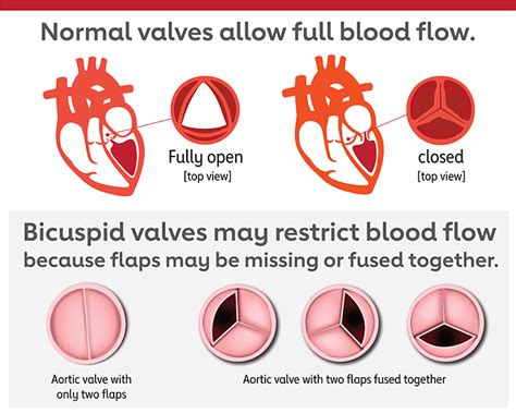 Roles Of Your Four Heart Valves American Heart Association Cpr And First Aid