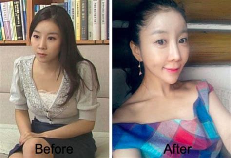 A South Korean Tv Presenter Pre And Post Plastic Surgery 6 Pics