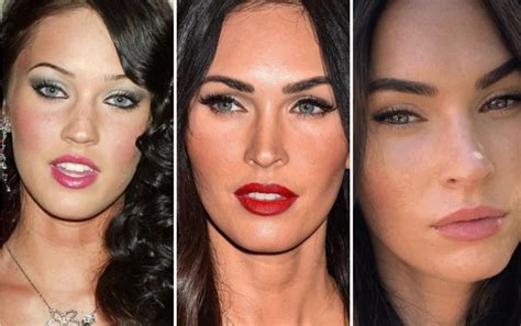 7 celebridades de hollywood que sus cirugías valen millones dato curioso