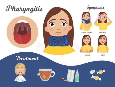 Pharyngitis Infographics Ilustracja Wektor Ilustracja Złożonej Z