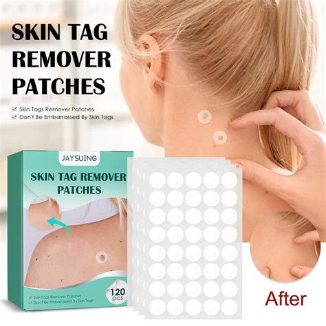 Fuan Jaysuing Wart Remover Patch Skin Tag Removal Patch Fleshy Flat