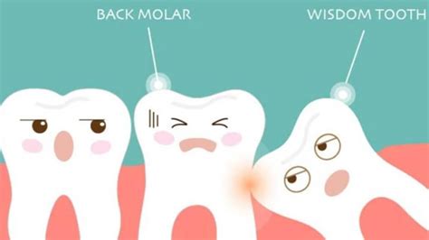 Five Common Signs To Get Your Wisdom Teeth Checked Out