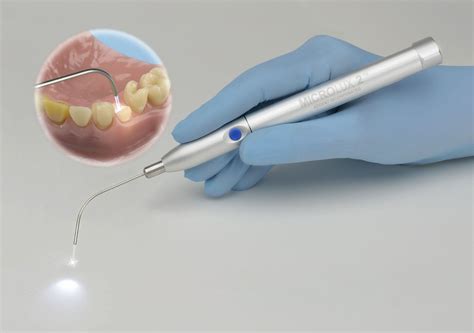 Transillumination Caries Detector Microlux 2 Diagnostic System Pn