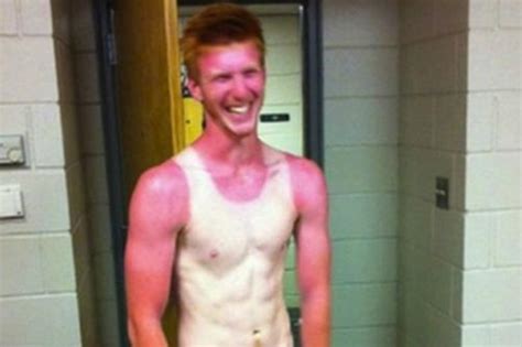 People Living With The World S Most Awkward Sun Tan Line Fails EVER