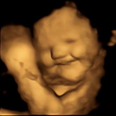 4d ultrasound shows fetuses reacting to taste smell auntminnie