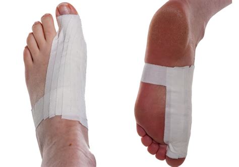 It happens most often in football players, but it can happen in other sports and. Turf Toe Taping | Physical Sports First Aid Blog