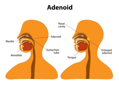 Tonsils And Adenoids Anatomy