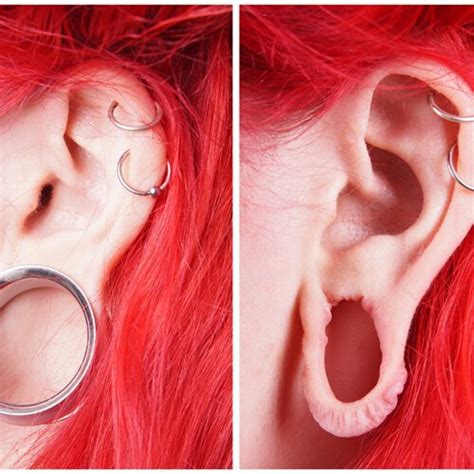 Split Earlobe Repairs On The Rise For Younger Generation