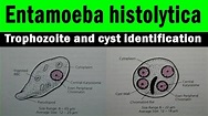Entamoeba histolytica trophozoite and cyst | microscopic view ((with ...