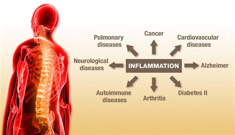 Symptoms may range from mild to severe. 20 Ways to Fight Inflammation | Monterey Bay Holistic Alliance