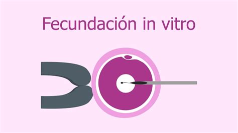 Fecundación in vitro FIV Proceso paso a paso YouTube